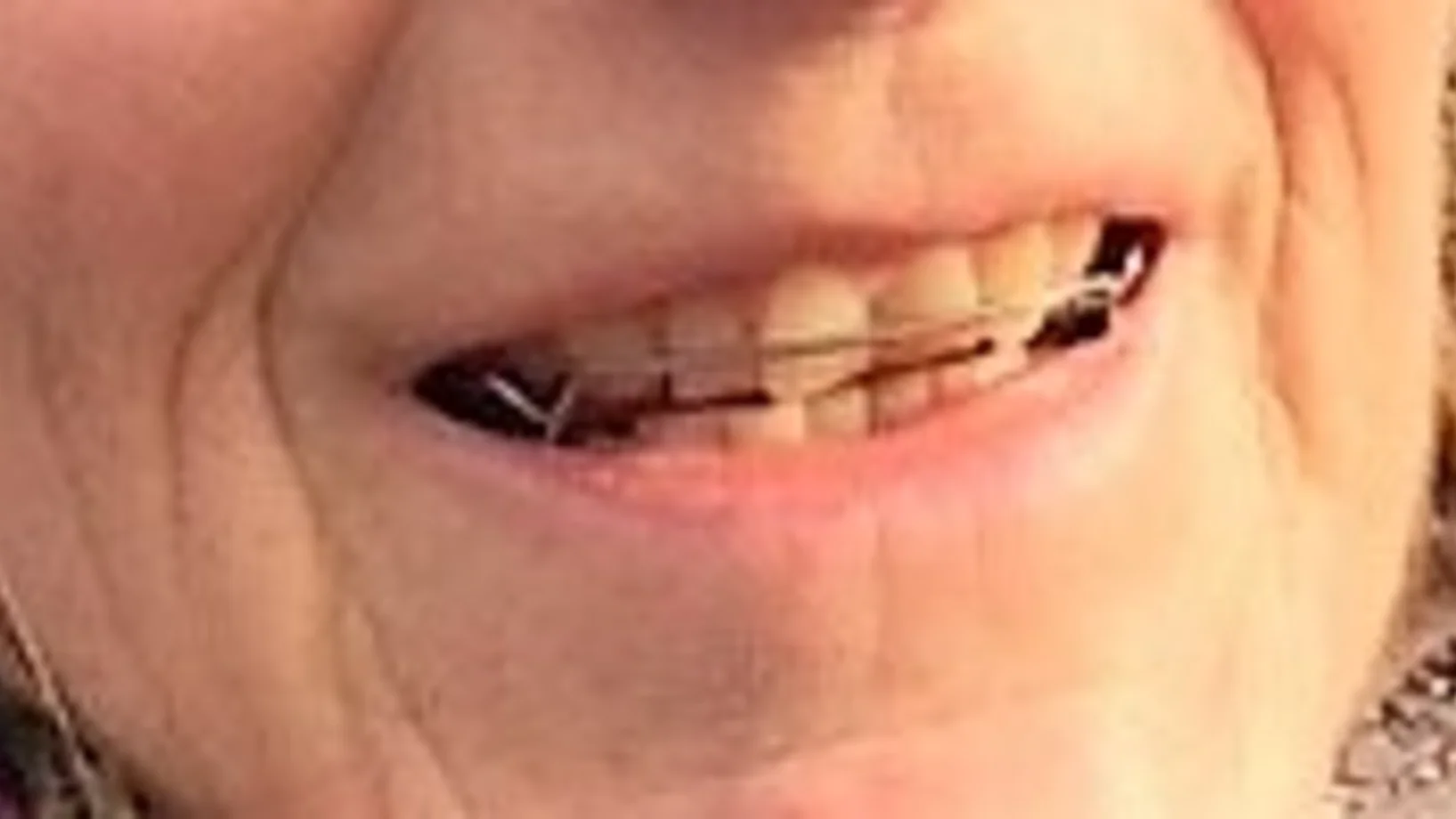 Draht im Mund 1_Sybille Wyss.jpg